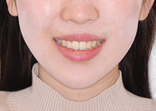 症例