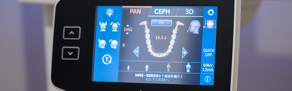 できるだけ抜かない矯正治療